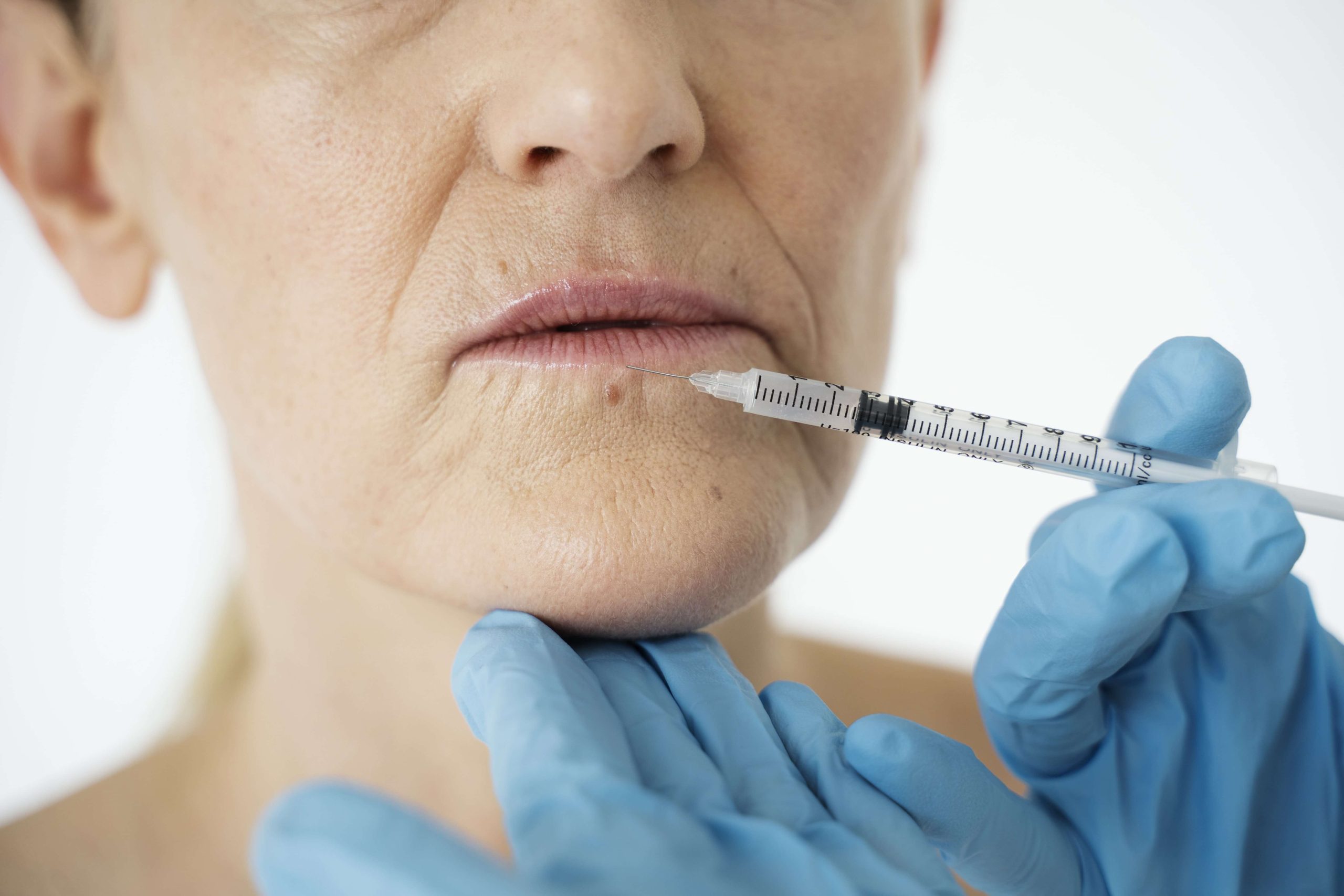 Injectări cu acid hialuronic