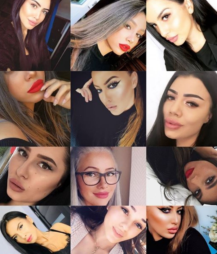 Mărire buze cu acid hialuronic