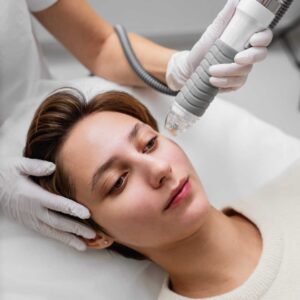 Microneedling